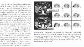 SISTEMA BILIAR PARTE 1audiolibro de cirugia pag 1547 en SABISTON hasta tto de aguda [upl. by Corella]