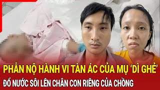 Điểm nóng Phẫn nộ hành vi tàn ác của ‘dì ghẻ’ Đổ nước sôi lên chân con trai riêng của chồng [upl. by Dent]