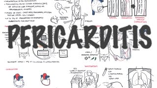 TTE Large Pericardial Effusion with Tamponade [upl. by Blaseio]