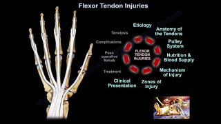 Flexor Tendon Injuries  Everything You Need To Know  Dr Nabil Ebraheim [upl. by Klos]