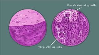 Menacing Mutations Examining the Role of the RAS Oncogene in Cancer Development [upl. by Agnimod798]