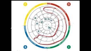 How DISC Helps Improve Teams [upl. by Puttergill]