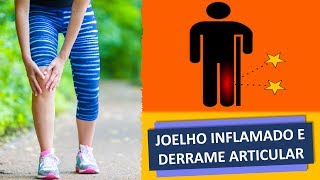 JOELHO INFLAMADO E DERRAME ARTICULAR [upl. by Mchale421]