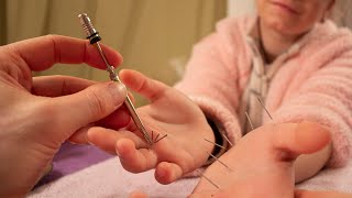 ASMR Hand Acupuncture Therapy Soft Talking [upl. by Acinorav35]