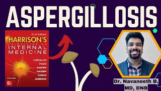 ASPERGILLOSIS  Pathogenesis  Clinical Features  Diagnosis  Treatment  Harrison [upl. by Iharas]