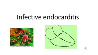 Infective endocarditis I Modified Dukes criteria I Medicine Lecture I MBBS [upl. by Muhan]