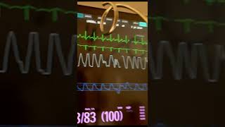 The History of PPG Photoplethysmography in 30seconds [upl. by Middlesworth]