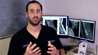 What is Radiculopathy  Dr Scott Raffa [upl. by Feldt]