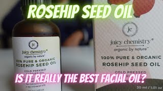 Juicy chemistry Rosehip Seed oil review  Best Facial Oil for oily skin [upl. by Breech755]