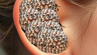 ASMR Ear Treatment And Deep Cleaning Animation  ASMR Dhekun Removal Infested Ear [upl. by Otrebliw]