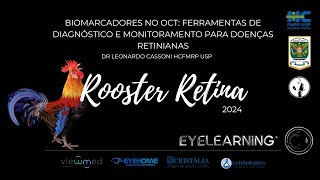 Biomarcadores no OCT Ferramentas de diagnóstico e monitoramento para Doenças Retinianas [upl. by Eenhpad]