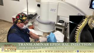 Translaminar Epidural Steroid Injections [upl. by Aikemehs295]