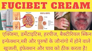 FUCIBET CREAM  हर तरह के स्किन इनफेक्शन और घाव को ठीक करने वाला दावा बैक्टीरियल इनफेक्शन का दावा [upl. by Nraa]