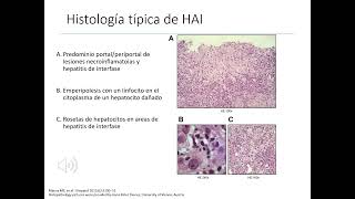 GASTROENTEROLOGÍA 7 Hepatitis crónica [upl. by Prissy877]