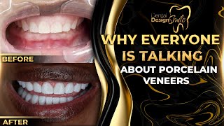 Why Everyone is Talking About Porcelain Veneers [upl. by Wilhelmina230]