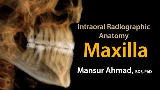 Intraoral Radiographic Anatomy of the Maxilla [upl. by Nial]