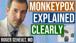 Monkeypox Mpox Explained Clearly [upl. by Elsworth220]