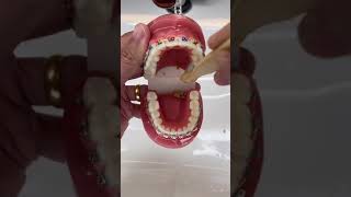 How to Brush your teeth when you have Braces on braces brush [upl. by Adnwahsar5]