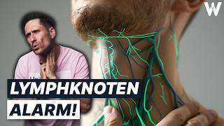 Unbekannte Knubbel Gefährlich von harmlos unterscheiden Wichtigsten Fakten zu großen Lymphknoten [upl. by Ekrub]