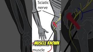 Physical Therapy Not Helping Sciatica Heres One Reason Why [upl. by Melville445]