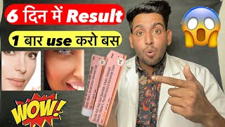 6 दिन में result  Ng glow cream  ng glow cream लड़के लड़कियों के लिए गोरे होने की क्रीम  Ng glow [upl. by Yrak255]