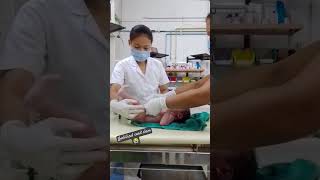 umbilical cord clam 😭newbornbaby youtube trending shortsviral [upl. by Ralip]