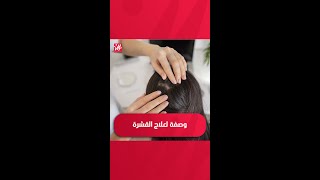 وصفة لعلاج القشرة مع الخبيرة مروى بلحوسين [upl. by Ivad]