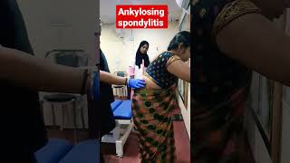 Ankylosing spondylitis treatment 93085113578409313131 drrajneeshkant [upl. by Appolonia648]