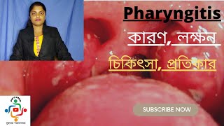 Pharyngitis In Bangla  Causes  Treatments  Home Remedies [upl. by Ayifas]