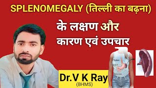 तिल्ली प्लीहा लक्षण कारण इलाज और निदान splemomegaly treatment in hindi 💯✅ [upl. by Michel358]