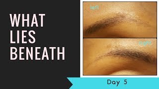 Microblading Day 5What Lies Beneath Pigment Fading [upl. by Otreblasiul]