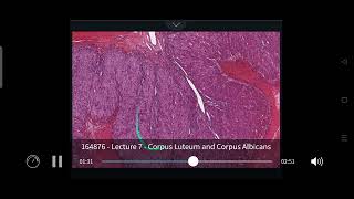 Corpus Luteum and Corpus Albicans [upl. by Theodor]