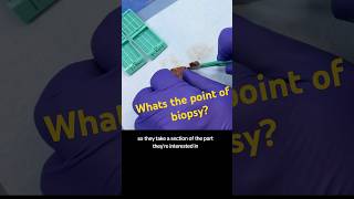 Whats the point of a biopsy humananatomy histology medicine histotechnology [upl. by Adriaens]