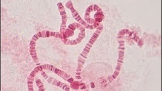 Polytene chromosome of Chironomus sp [upl. by Keen]