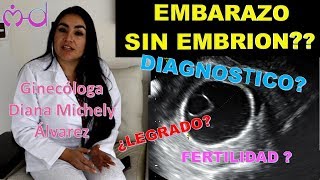 EMBARAZO ANEMBRIONADO POR GINECOLOGA DIANA ALVAREZ [upl. by Eitsrik]