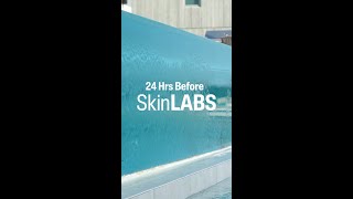 24 Hours Malibu SkinLabs Cetaphil Behind the Scenes [upl. by Nilauqcaj]