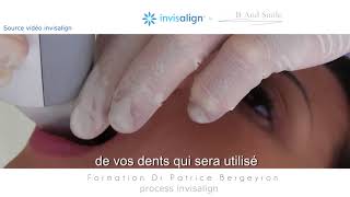 Invisalign Comment ça marche [upl. by Mcclees]