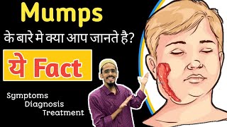 Mumps disease in hindi  mumps Symptoms  mumps diagnosis  mumps treatment in hindi [upl. by Ahsaret]