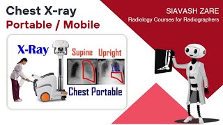 Chest Xray Portable upright semiupright supine Positioning and Technique [upl. by Enilorac]