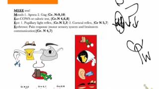 USMLE shortcuts Brainstem death tests2 details [upl. by Suiraj]