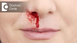 What causes bloody nose while sleeping  Dr Lakshmi Ponnathpur [upl. by Mcnamara]