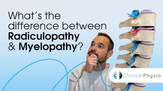 What’s the difference between Radiculopathy and Myelopathy  Expert Physio Guide [upl. by Walford]