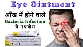 How To Put Eye Ointment In Your Eye  The Best Way To Use Eye Ointment [upl. by Alfred]