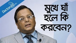 Mouth ulcers home remedy  Mouth ulcers treatments  What causes mouth ulcers  Health Tips Bangla [upl. by Paulo]