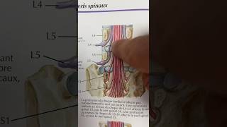 Réponse Quiz sur sténose foraminale  hernie discale [upl. by Desma]