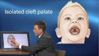 Cleft Treatment  Pediatric Playbook  Boston Childrens Hospital [upl. by Ag]