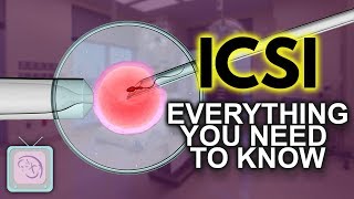 IVF ICSI Procedure  Important things you need to know [upl. by Jannelle]