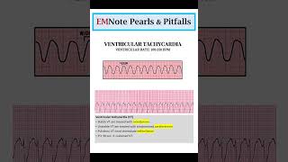 ACLS Cardiac Arrhythmias [upl. by Schoenberg]