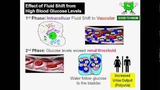 Diabetic Ketoacidosis Physiology DKA [upl. by Aurie]