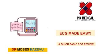 ECG made easy [upl. by Kirk]